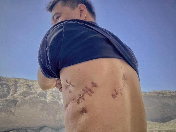 走进天山深处 听新疆干警还原“9·18”暴恐案生死较量