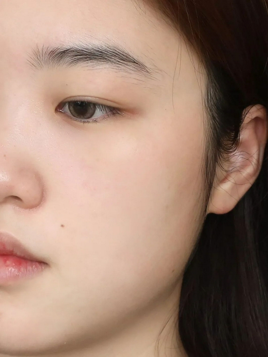 使用后（使用效果因人而异）